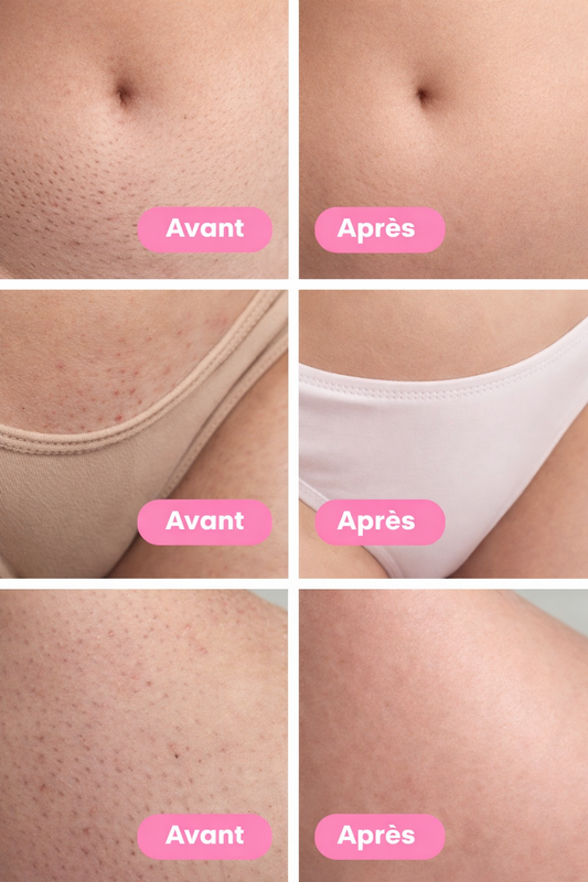 Lumina SmoothShave™